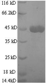 Recombinant Mouse Collagenase 3(Mmp13)