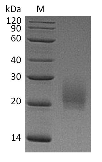 Recombinant Mouse Cytotoxic T-lymphocyte protein 4(Ctla4),partial (Active)