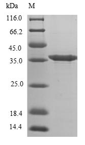 Recombinant Mouse Decorin(Dcn),partial