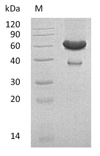 Recombinant Mouse Ephrin-A1(Efna1),partial (Active)