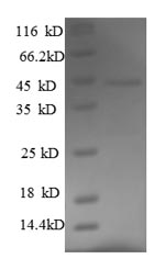 Recombinant Mouse Fas apoptotic inhibitory molecule 3(Fcmr) ,partial