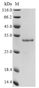 Recombinant Mouse Galectin-3(Lgals3)
