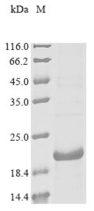 Recombinant Mouse Gastric inhibitory polypeptide receptor(Gipr),partial