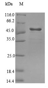 Recombinant Mouse Glyoxylate reductase/hydroxypyruvate reductase(Glxr)