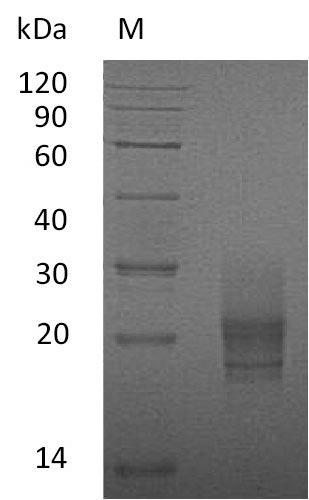 Recombinant Mouse Granulocyte-macrophage colony-stimulating factor(Csf2) (Active)