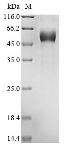 Recombinant Mouse Heme-binding protein 1(Hebp1)