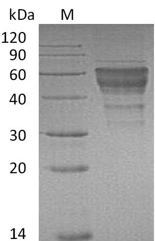 Recombinant Mouse Hepatitis A virus cellular receptor 2 homolog(Havcr2),partial (Active)