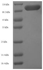 Recombinant Mouse Hydroxymethylglutaryl-CoA synthase, Cytoplasmic(Hmgcs1)