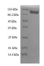 Recombinant Mouse Importin subunit beta-1(Kpnb1)