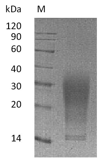 Recombinant Mouse Interleukin-13(Il13),partial (Active)