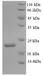 Recombinant Mouse Interleukin-18-binding protein(Il18bp)