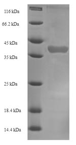 Recombinant Mouse Kallikrein 1-related peptidase b22(Klk1b22)