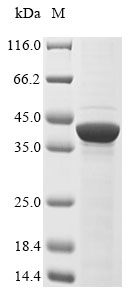 Recombinant Mouse Left-right determination factor 2(Lefty2)