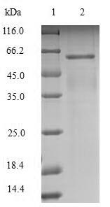 Recombinant Mouse Leucine-rich repeat and immunoglobulin-like domain-containing nogo receptor-interacting protein 1(Lingo1),partial