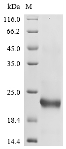 Recombinant Mouse Leukocyte cell-derived chemotaxin-2(Lect2)