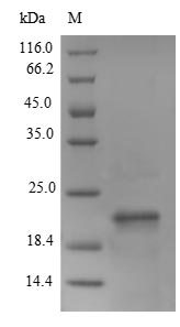 Recombinant Mouse Lymphocyte antigen 6E(Ly6e)