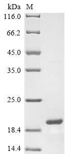 Recombinant Mouse Lysozyme C-2(Lyz2)