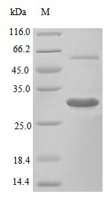 Recombinant Mouse Macrophage colony-stimulating factor 1 protein(Csf1),partial (Active)