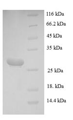 Recombinant Mouse Mast cell protease 4(Mcpt4)