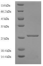 Recombinant Mouse Murinoglobulin-1(Mug1) ,partial