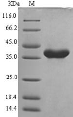 Recombinant Mouse NACHT, LRR and PYD domains-containing protein 3(Nlrp3),partial