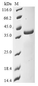 Recombinant Mouse NAD-dependent protein deacylase sirtuin-5, mitochondrial(Sirt5)