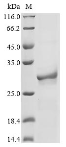 Recombinant Mouse Nicotinamide riboside kinase 1(Nrk1)