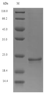Recombinant Mouse Osteocalcin(Bglap)