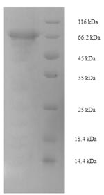Recombinant Mouse Pancreatic secretory granule membrane major glycoprotein GP2(Gp2) 