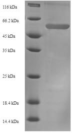 Recombinant Mouse Plasminogen activator inhibitor 1(Serpine1)
