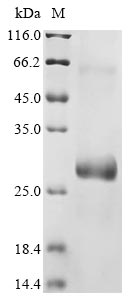 Recombinant Mouse Protein PML(Pml),partial