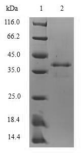 Recombinant Mouse Protein S100-A8(S100a8)
