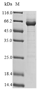 Recombinant Mouse Protein SAAL1(Saal1)