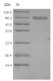 Recombinant Mouse Putative phospholipase B-like 2(Plbd2)