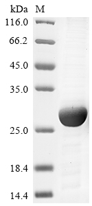 Recombinant Mouse Ras-related protein Rab-10(Rab10)