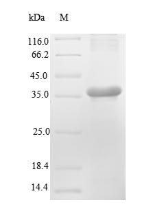 Recombinant Mouse Renin-2(Ren2),partial