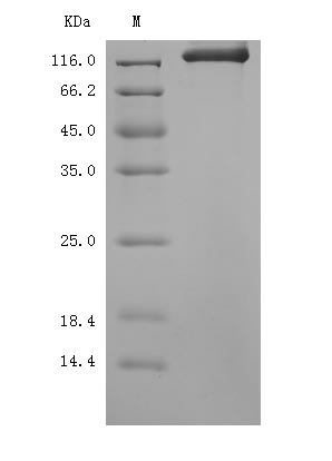 Recombinant Mouse Semaphorin-4D(Sema4d),partial (Active)