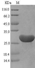 Recombinant Mouse Serum amyloid A-1 protein(Saa1)