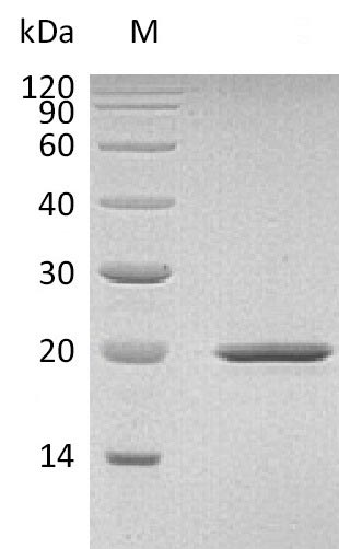 Recombinant Mouse Sonic hedgehog protein(Shh),partial (Active)