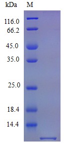 Recombinant Mouse Stromal cell-derived factor 1 protein(Cxcl12) (Active)