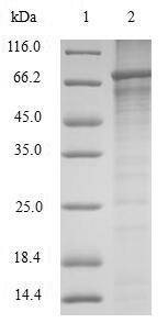 Recombinant Mouse Sushi repeat-containing protein SRPX2(Srpx2)