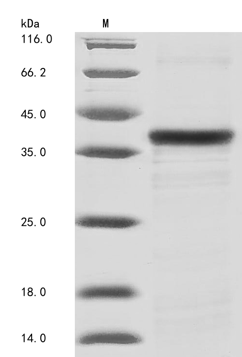 Recombinant Mouse Tenomodulin(Tnmd),partial