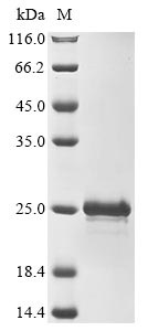 Recombinant Mouse Thymosin beta-10(Tmsb10)