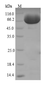 Recombinant Mouse Tissue alpha-L-fucosidase(Fuca1)