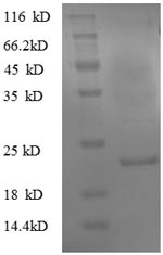 Recombinant Mouse Translationally-controlled tumor protein(Tpt1)