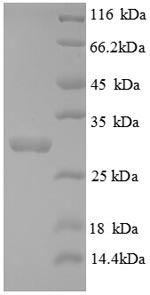 Recombinant Mouse Tryptase(Tpsab1),partial