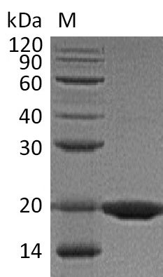 Recombinant Mouse Tumor necrosis factor ligand superfamily member 11(Tnfsf11),partial (Active)