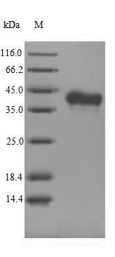 Recombinant Mouse Tumor necrosis factor ligand superfamily member 11(Tnfsf11),partial