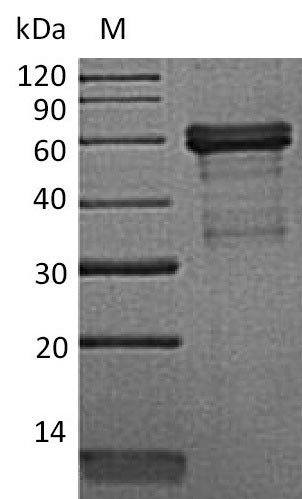 Recombinant Mouse Tumor necrosis factor receptor superfamily member 14(Tnfrsf14),partial (Active)