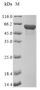 Recombinant Mouse Vimentin(Vim)